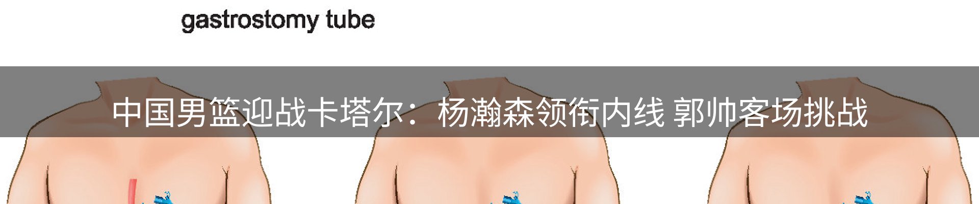 体育资讯
